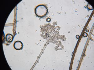 scab on an apple tree under a microscope